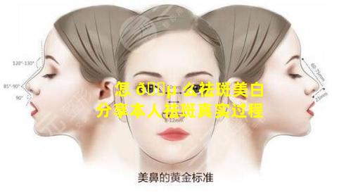 怎 🌵 么祛斑美白分享本人祛斑真实过程